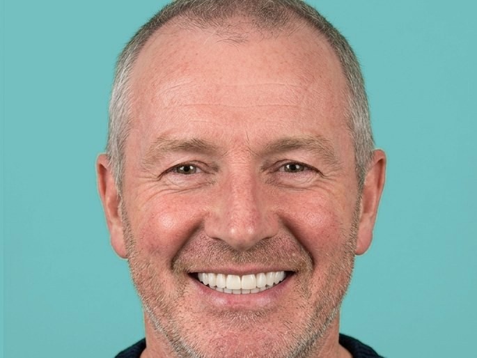 Illustration: a full, even smile after treatment