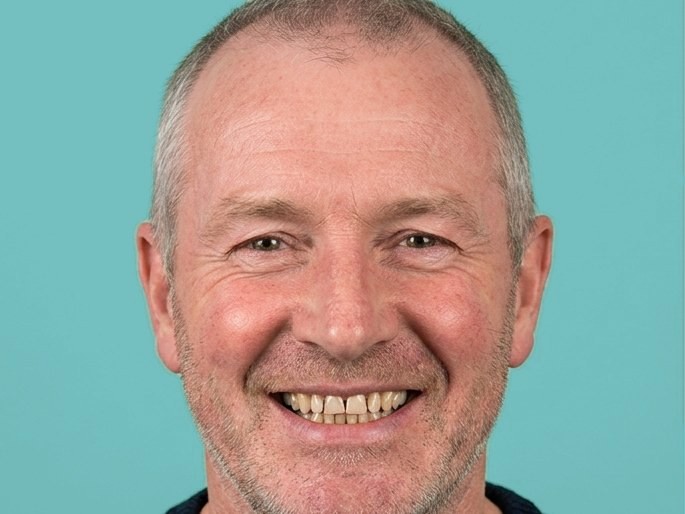 Illustration: worn, uneven teeth before treatment